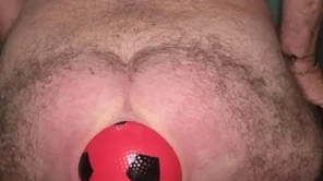 World record 13 cm wide anal flourishing adjacent to inflatable ball.