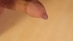Phimosis cock great cumshot